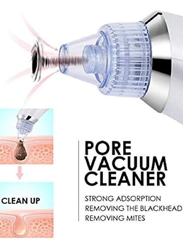 Derma Suction Facial Pore Cleanser - Blackhead Whitehead Remover Suction Machine